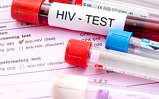 Rośnie liczba zakażonych wirusem HIV